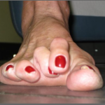 crossover toe