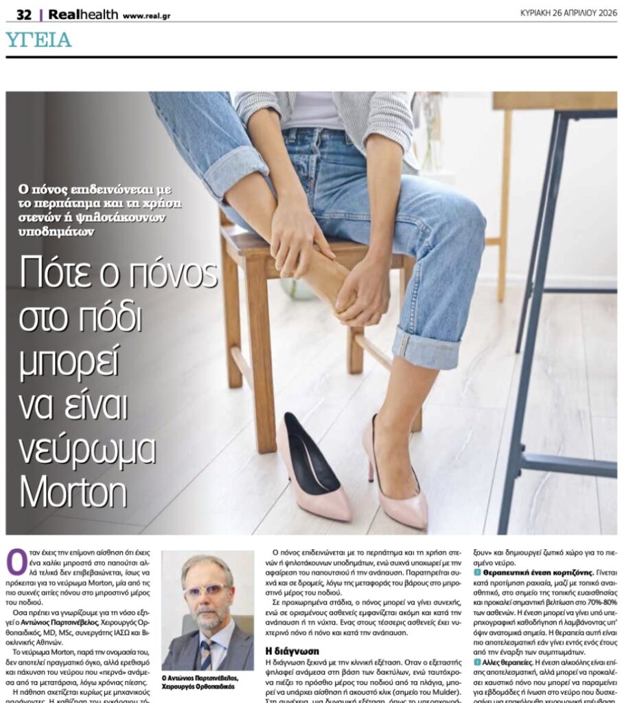 νεύρωμα morton